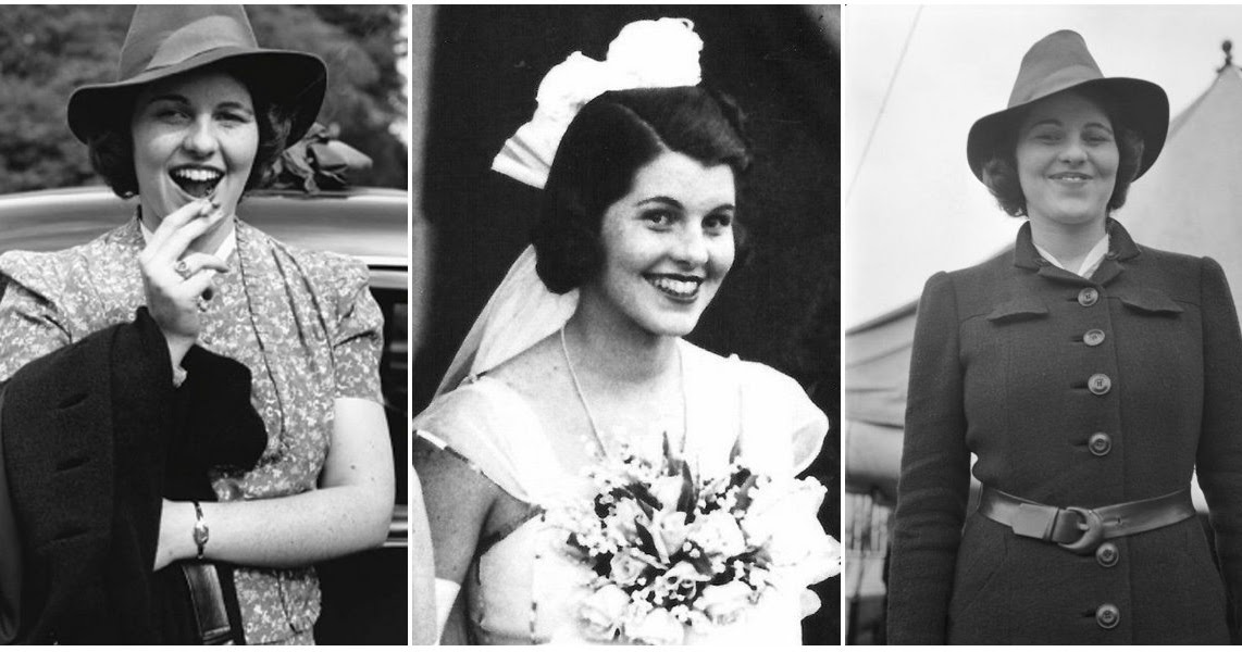 Rosemary Kennedy Before And After Lobotomy 