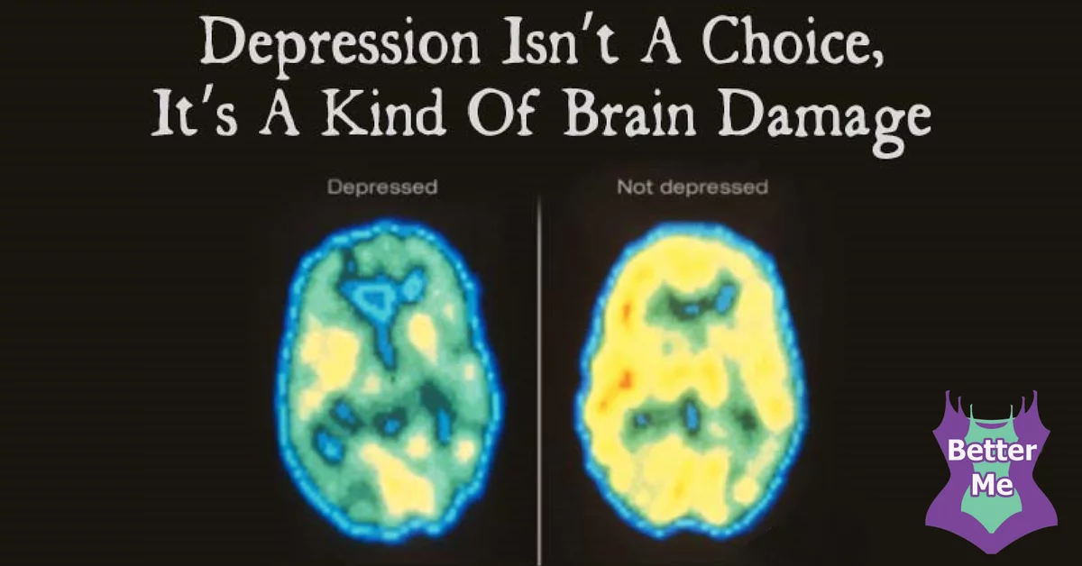 Chemicals in brain that cause depression