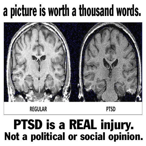 Psychosis and ptsd