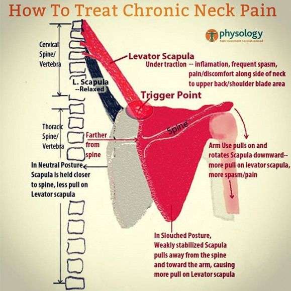 Bipolar and chronic back pain