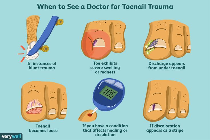 How to treat trauma in therapy