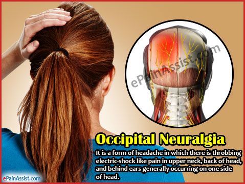 Stabbing pain in left side 2025 of head