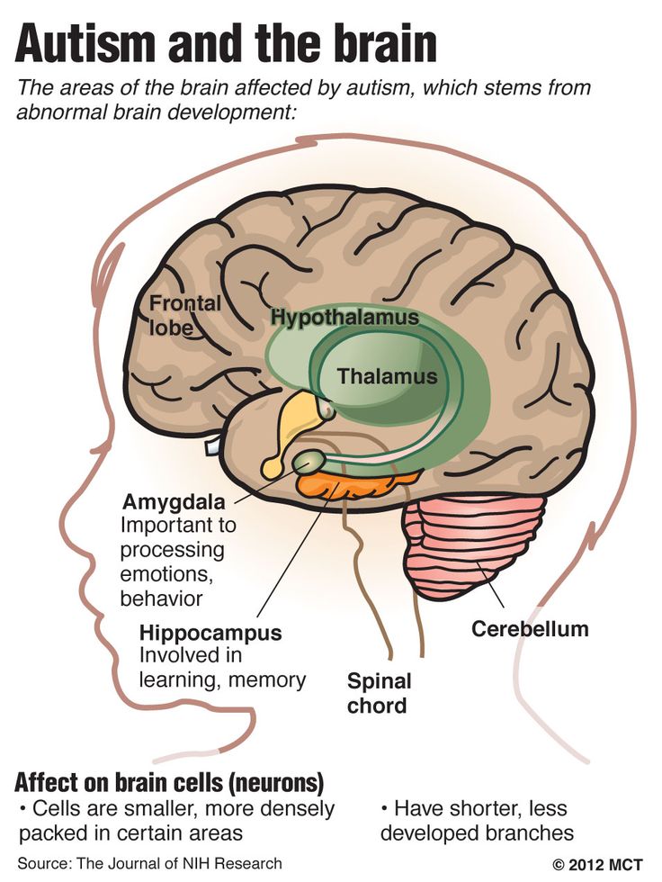 The 3 Levels of Autism: Symptoms and Support Needs