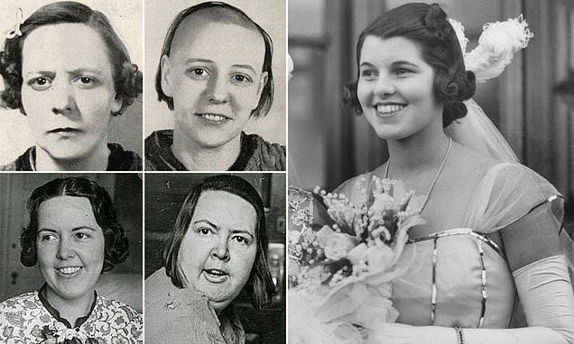 Rosemary Kennedy Before And After Lobotomy 