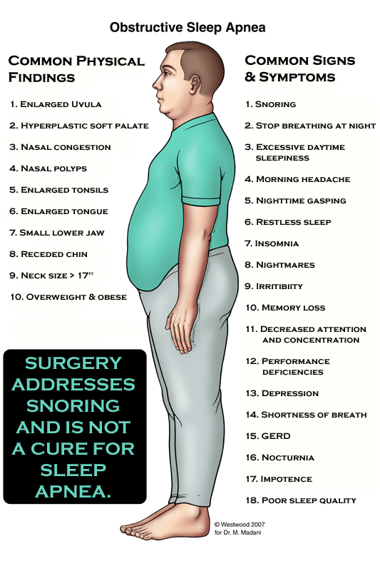 Physical finding. Апноэ во сне симптомы. Sleep Apnea Symptoms. Апноэ симптомы. Апноэ сна картинки.