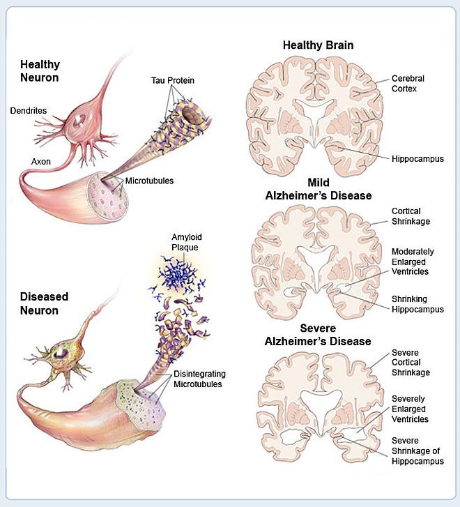 Changing the brain