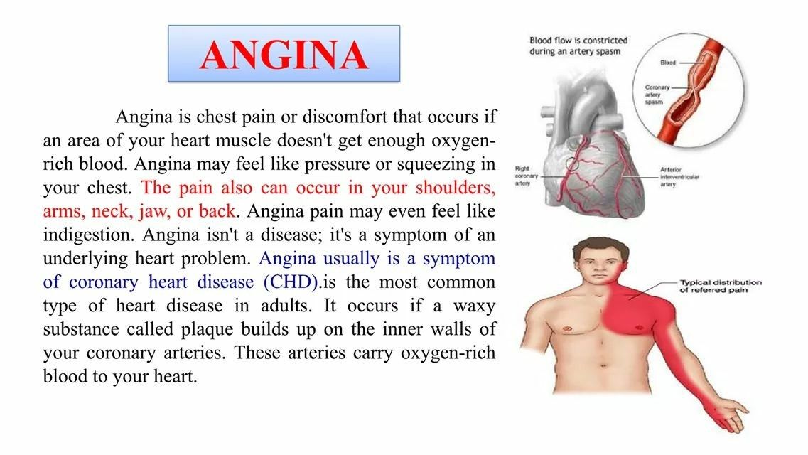 Anxiety chest pains symptoms