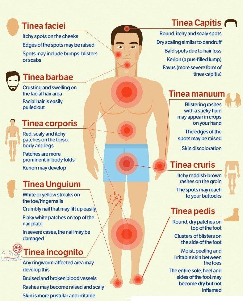 Does stress cause itchy skin