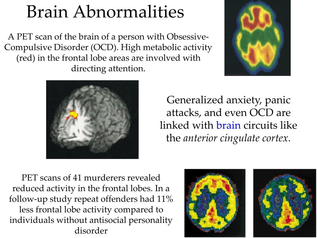 Brain disorders