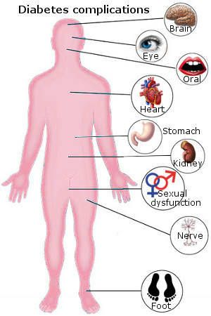 Complications of ect