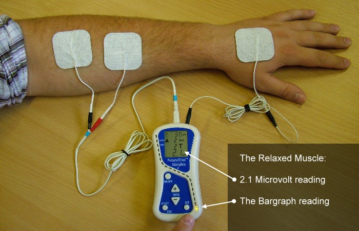 Comment placer les électrodes ? : Neurotrac Shop