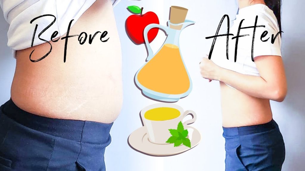 How to stop bulimia bloat