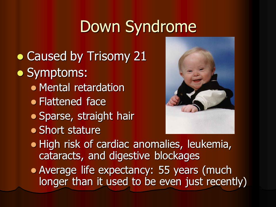 Down Syndrome Pussy