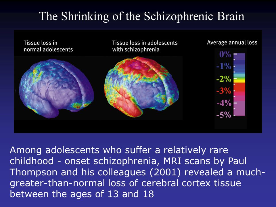 Working with schizophrenics