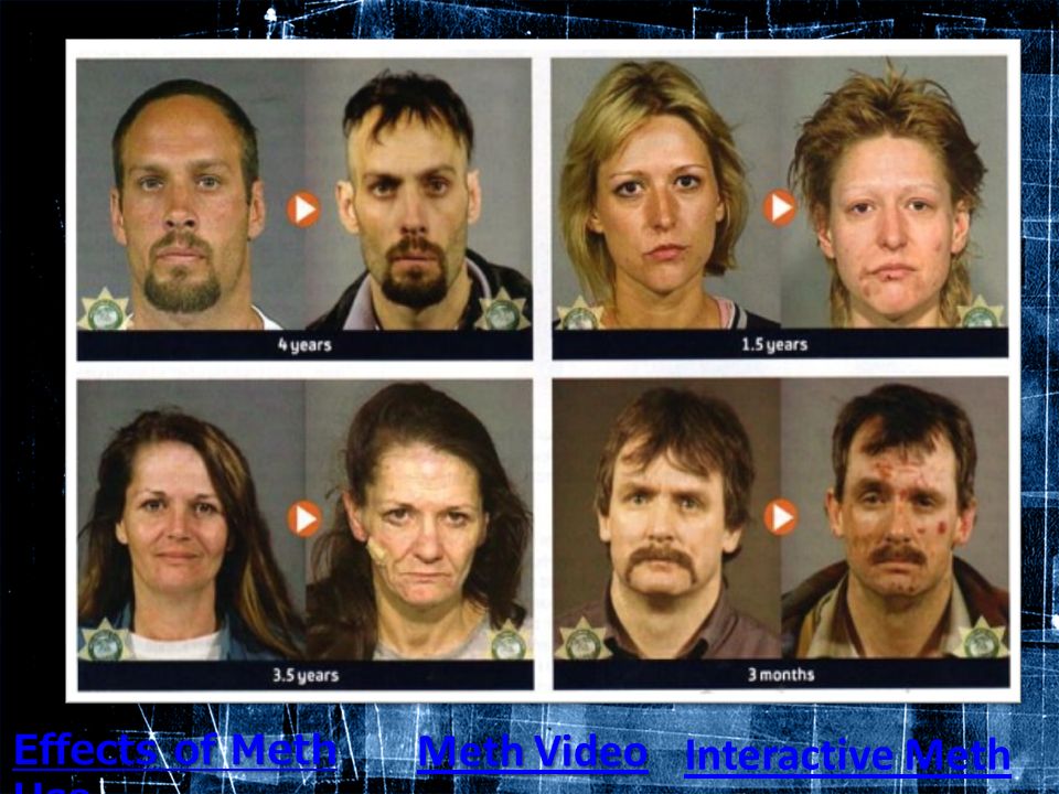Crystal meth and bipolar disorder